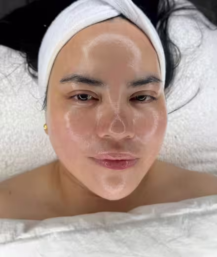 Antes del Dermaplaning en piel opaca - Bogotá
