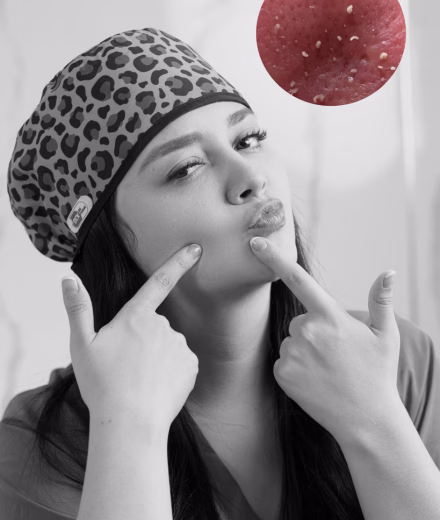 Testimonio de Sofía, paciente de limpieza facial medicalizada en Bogotá