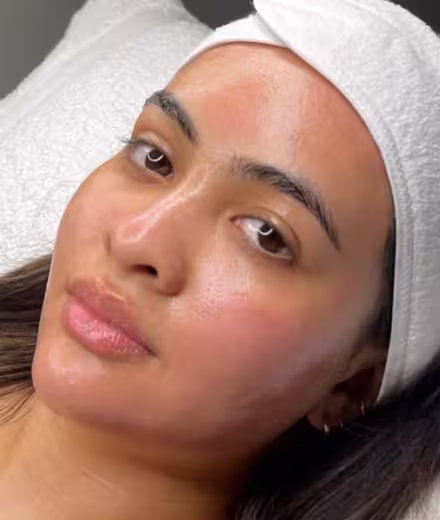 Vello facial antes del dermaplaning